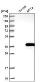 Anti-ACY3 antibody produced in rabbit Prestige Antibodies® Powered by Atlas Antibodies, affinity isolated antibody, buffered aqueous glycerol solution