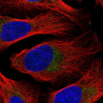 Anti-DDX28 antibody produced in rabbit Prestige Antibodies&#174; Powered by Atlas Antibodies, affinity isolated antibody