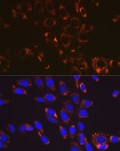 Anti-SOD2 antibody produced in rabbit