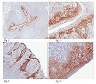Anti-Desmoglein-1 Antibody, clone 32-2B clone 32-2B, from mouse