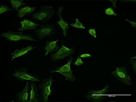 Monoclonal Anti-VCL antibody produced in mouse clone 3F8-1D4, purified immunoglobulin, buffered aqueous solution