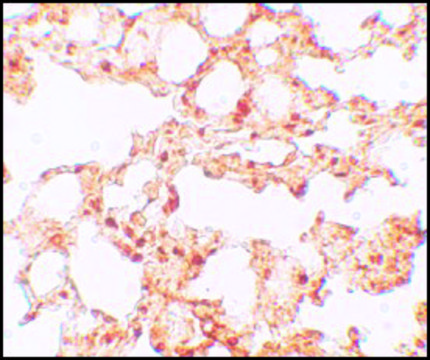 Anti-ZIP6 antibody produced in rabbit affinity isolated antibody, buffered aqueous solution