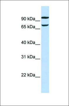 Anti-FAM38B antibody produced in rabbit affinity isolated antibody