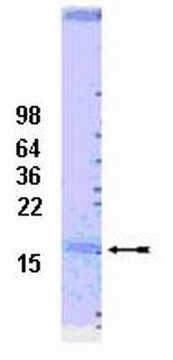 UbcH7结合酶，100 &#181;g UbcH7 is a class I enzyme which functions in the stress response &amp; the control of transcription factors. The enzyme is ubiquitously expressed with high levels of expression seen in adult muscle.