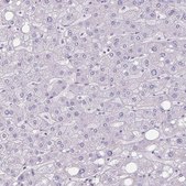 Anti-CHST3 antibody produced in rabbit Prestige Antibodies® Powered by Atlas Antibodies, affinity isolated antibody, buffered aqueous glycerol solution