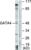 Anti-GATA4 antibody produced in rabbit affinity isolated antibody