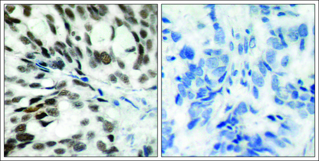 Anti-RB1 (Ab-780) antibody produced in rabbit affinity isolated antibody