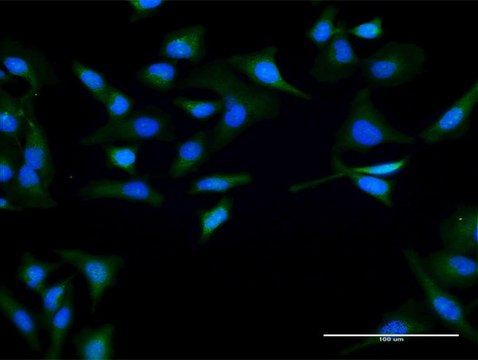 Anti-SPO11 antibody produced in rabbit purified immunoglobulin, buffered aqueous solution