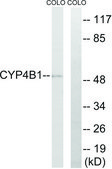 Anti-Cytochrome P450 4B1 antibody produced in rabbit affinity isolated antibody