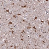 Anti-AKAP5 antibody produced in rabbit Prestige Antibodies® Powered by Atlas Antibodies, affinity isolated antibody, buffered aqueous glycerol solution