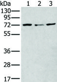 Anti-MTHFR affinity isolated antibody
