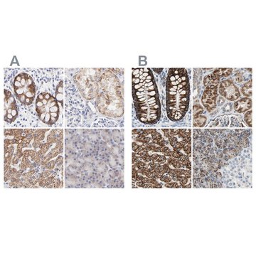 Anti-TST antibody produced in rabbit Ab1, Prestige Antibodies&#174; Powered by Atlas Antibodies, affinity isolated antibody, buffered aqueous glycerol solution