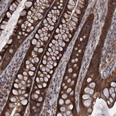 Anti-HAUS1 antibody produced in rabbit Prestige Antibodies® Powered by Atlas Antibodies, affinity isolated antibody, buffered aqueous glycerol solution