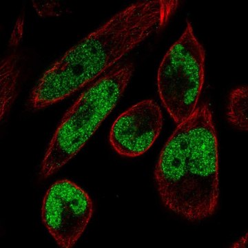 Anti-MAMLD1 antibody produced in rabbit Prestige Antibodies&#174; Powered by Atlas Antibodies, affinity isolated antibody, buffered aqueous glycerol solution