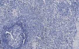 Anti-ATG9A Antibody, clone 5B11, ZooMAb® Rabbit Monoclonal recombinant, expressed in HEK 293 cells