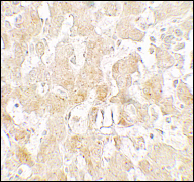 Anti-UCP1 antibody produced in rabbit affinity isolated antibody