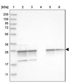 Anti-PSMA5 antibody produced in rabbit Prestige Antibodies® Powered by Atlas Antibodies, affinity isolated antibody, buffered aqueous glycerol solution, ab2