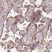 Anti-RASA1 antibody produced in rabbit Prestige Antibodies® Powered by Atlas Antibodies, affinity isolated antibody