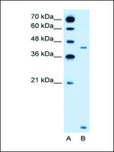 Anti-SLC46A3 antibody produced in rabbit IgG fraction of antiserum
