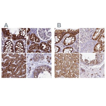 Anti-UQCRFS1 antibody produced in rabbit Prestige Antibodies&#174; Powered by Atlas Antibodies, affinity isolated antibody, buffered aqueous glycerol solution