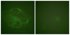 Anti-HRS antibody produced in rabbit affinity isolated antibody
