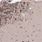 Anti-NOA1 antibody produced in rabbit Prestige Antibodies® Powered by Atlas Antibodies, affinity isolated antibody, buffered aqueous glycerol solution