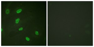 Anti-Histone H2B (Acetyl-Lys5) antibody produced in rabbit affinity isolated antibody
