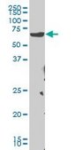Monoclonal Anti-CHEK2 antibody produced in mouse clone 4F10, purified immunoglobulin, buffered aqueous solution