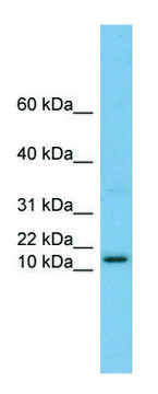 Anti-HRK (N-terminal) antibody produced in rabbit affinity isolated antibody