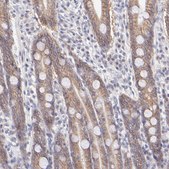 Anti-PBDC1 antibody produced in rabbit Prestige Antibodies® Powered by Atlas Antibodies, affinity isolated antibody, buffered aqueous glycerol solution
