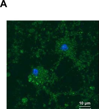 Anti-YB-1 (C-terminal) antibody produced in rabbit ~1.0&#160;mg/mL, affinity isolated antibody, buffered aqueous solution