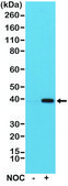 Anti-Aurora-B antibody, Rabbit monoclonal recombinant, expressed in HEK 293 cells, clone RM278, purified immunoglobulin