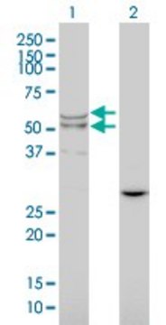 Monoclonal Anti-LIPA antibody produced in mouse clone 1F9, purified immunoglobulin, buffered aqueous solution