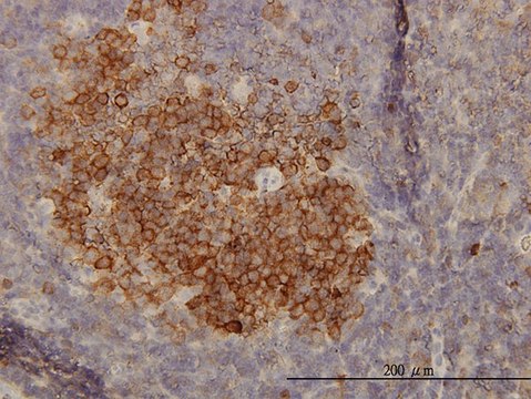 Monoclonal Anti-PHGDH antibody produced in mouse clone 4A3-1D6, purified immunoglobulin, buffered aqueous solution