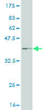 Monoclonal Anti-CPT2 antibody produced in mouse clone 1G7, purified immunoglobulin, buffered aqueous solution