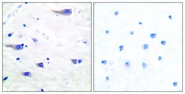 Anti-PDGF Receptor &#946; antibody produced in rabbit affinity isolated antibody