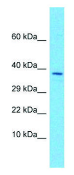 Anti-EGFLAM (C-terminal) antibody produced in rabbit affinity isolated antibody