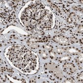 Anti-RFX5 antibody produced in rabbit Prestige Antibodies® Powered by Atlas Antibodies, affinity isolated antibody, buffered aqueous glycerol solution