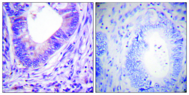 Anti-PKA &#945; antibody produced in rabbit affinity isolated antibody