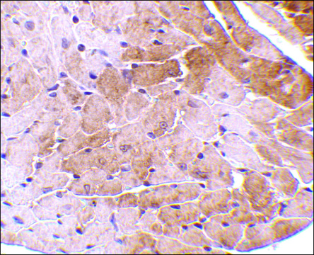 Anti-CIDE-A (ab1) antibody produced in rabbit affinity isolated antibody, buffered aqueous solution