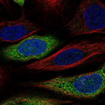 Anti-CAPZA2 antibody produced in rabbit Prestige Antibodies&#174; Powered by Atlas Antibodies, affinity isolated antibody