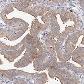 Anti-WDR77 antibody produced in rabbit Prestige Antibodies® Powered by Atlas Antibodies, affinity isolated antibody, buffered aqueous glycerol solution, ab2