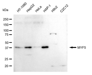 Anti Myogenic Factor 5 Antibody, clone 24GB615, Rabbit Monoclonal clone 24GB615, recombinant rabbit monoclonal, expressed in HEK293 cells