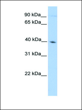 Anti-ODF2 antibody produced in rabbit affinity isolated antibody