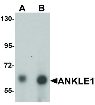 Anti-ANKLE1 antibody produced in chicken affinity isolated antibody