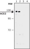 Anti-ACE2 (N-terminal) antibody produced in rabbit affinity isolated antibody, buffered aqueous solution