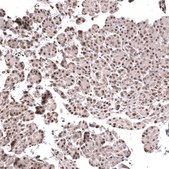 Monoclonal Anti-Foxo3 Antibody Produced In Mouse Prestige Antibodies® Powered by Atlas Antibodies, clone CL13603, affinity isolated antibody, buffered aqueous glycerol solution