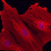 Anti-Parvalbumin antibody, Mouse monoclonal clone PARV-19, purified from hybridoma cell culture