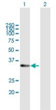 Anti-RDH12 antibody produced in mouse purified immunoglobulin, buffered aqueous solution