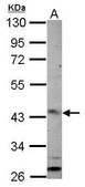 Anti-ARL13B antibody produced in rabbit affinity isolated antibody, buffered aqueous solution
